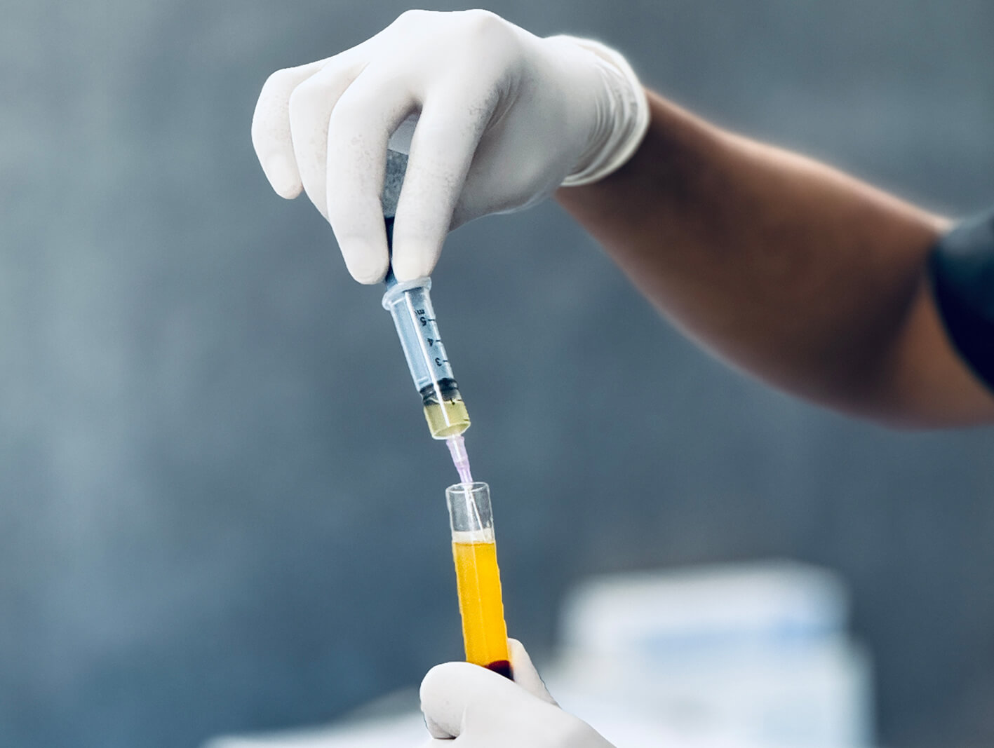PRP skin rejuvenation